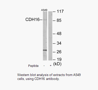 Product image for CDH16 Antibody