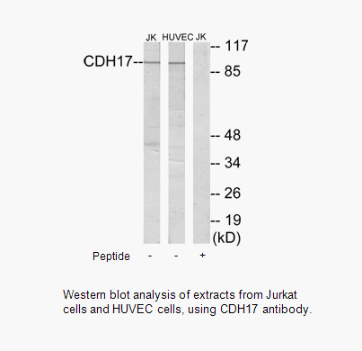 Product image for CDH17 Antibody