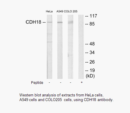 Product image for CDH18 Antibody