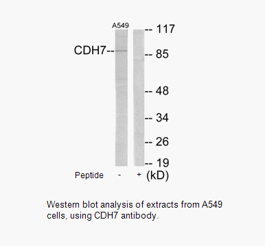 Product image for CDH7 Antibody