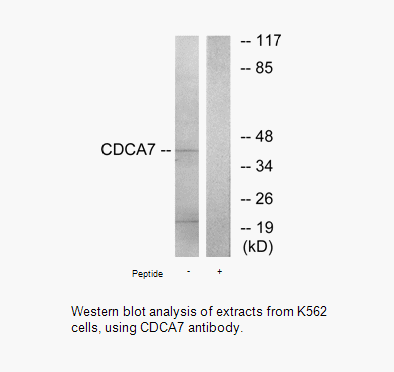 Product image for CDCA7 Antibody