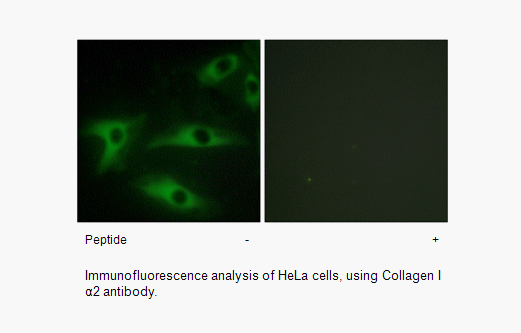 Product image for Collagen I &alpha;2 Antibody