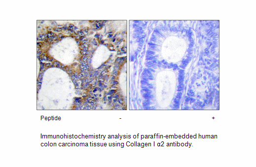 Product image for Collagen I &alpha;2 Antibody