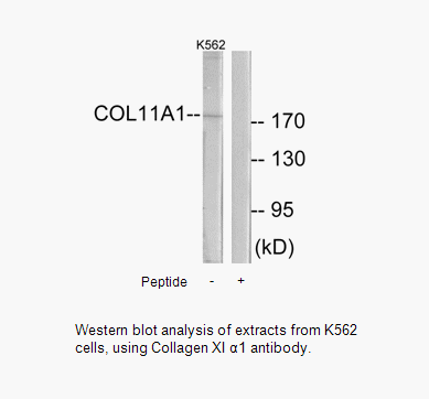 Product image for Collagen XI &alpha;1 Antibody