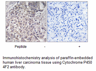Product image for Cytochrome P450 4F2 Antibody