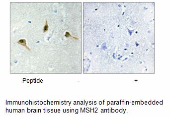Product image for MSH2 Antibody