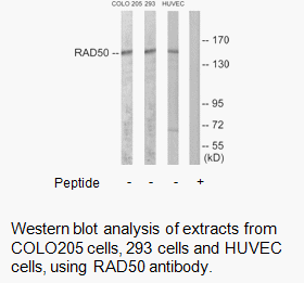 Product image for RAD50 Antibody