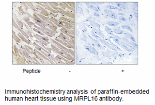 Product image for MRPL16 Antibody