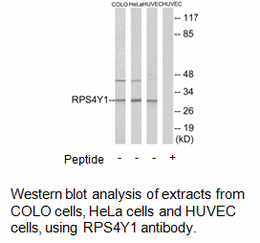 Product image for RPS4Y1 Antibody