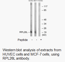 Product image for RPL26L Antibody