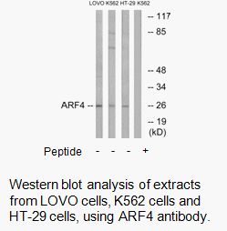 Product image for ARF4 Antibody