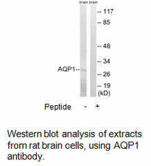 Product image for AQP1 Antibody