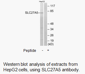 Product image for SLC27A5 Antibody
