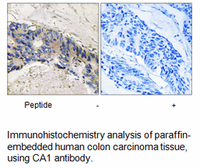 Product image for CA1 Antibody