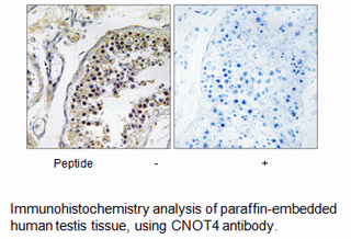 Product image for CNOT4 Antibody