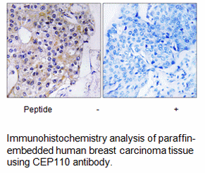 Product image for CEP110 Antibody