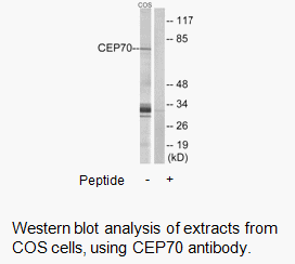 Product image for CEP70 Antibody