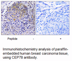 Product image for CEP78 Antibody
