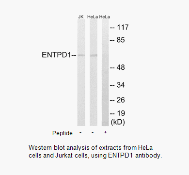 Product image for ENTPD1 Antibody