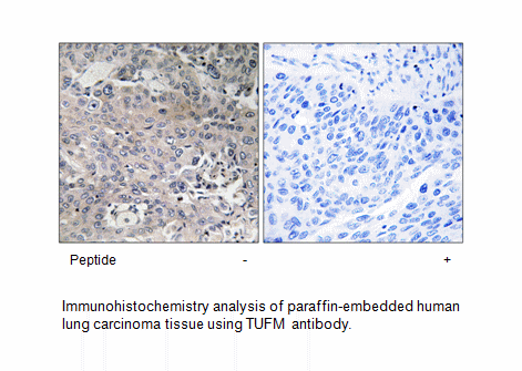 Product image for TUFM Antibody