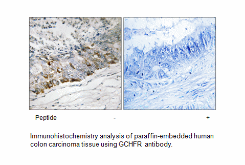 Product image for GCHFR Antibody