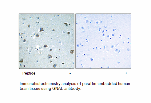 Product image for GNAL Antibody