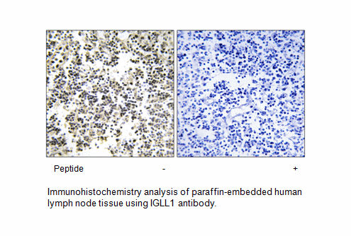 Product image for IGLL1 Antibody