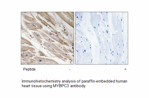 Product image for MYBPC3 Antibody