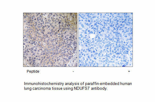 Product image for NDUFS7 Antibody