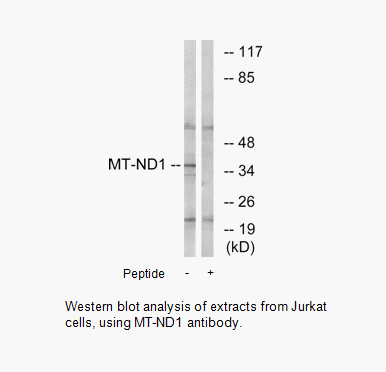 Product image for MT-ND1 Antibody