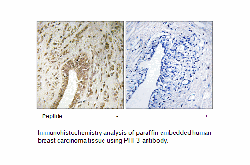 Product image for PHF3 Antibody