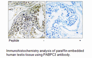 Product image for PABPC3 Antibody