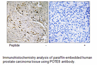 Product image for POTE8 Antibody