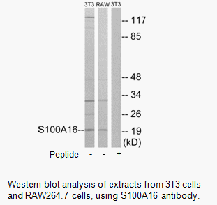 Product image for S100A16 Antibody