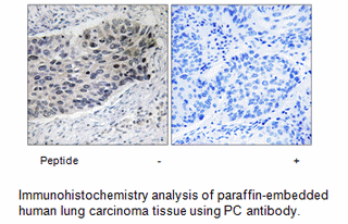 Product image for PC Antibody