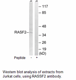 Product image for RASSF2 Antibody