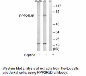 Product image for PPP2R5D Antibody