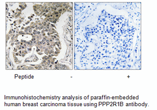 Product image for PPP2R1B Antibody