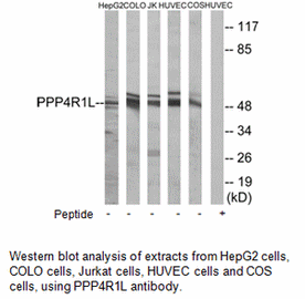 Product image for PPP4R1L Antibody