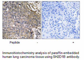 Product image for SH2D1B Antibody