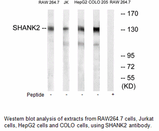 Product image for SHANK2 Antibody