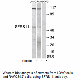 Product image for SFRS11 Antibody
