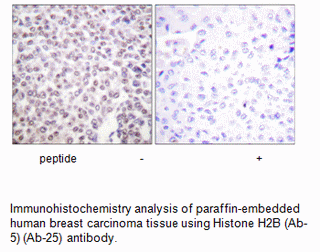 Product image for Histone H2B (Ab-5) Antibody