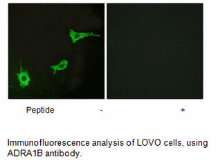 Product image for ADRA1B Antibody