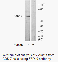 Product image for FZD10 Antibody