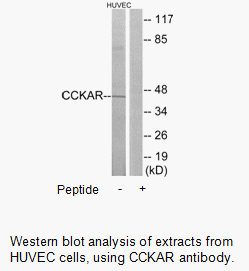 Product image for CCKAR Antibody