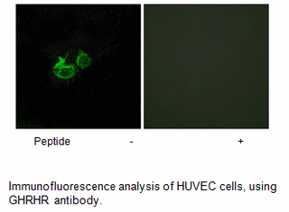 Product image for GHRHR Antibody