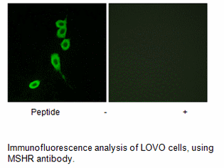 Product image for MSHR Antibody