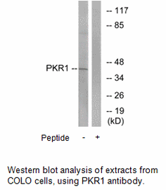 Product image for PKR1 Antibody