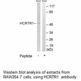 Product image for HCRTR1 Antibody